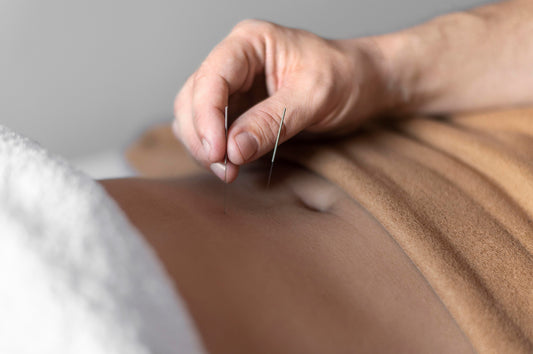 Acupuncture Follow-Up Treatments